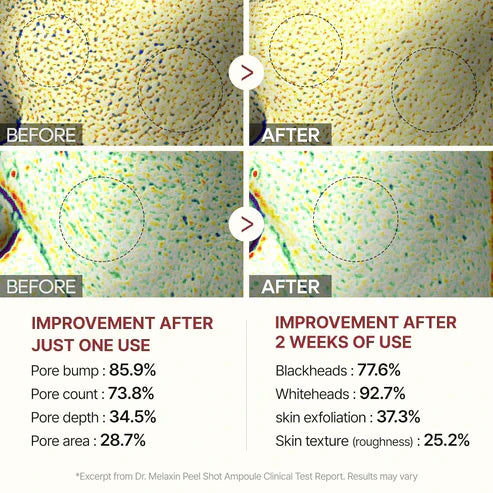 Sassy Black Rice Peel Shot Glow