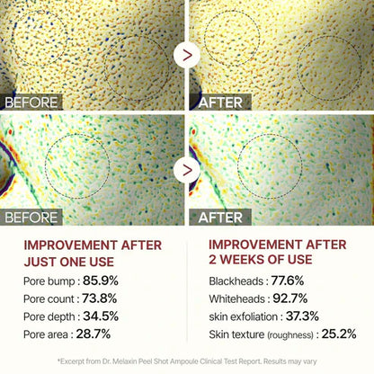 Sassy Black Rice Peel Shot Glow