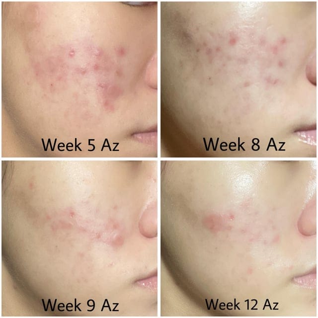 Celimax The Vita-A Retinal Shot Tightening Booster