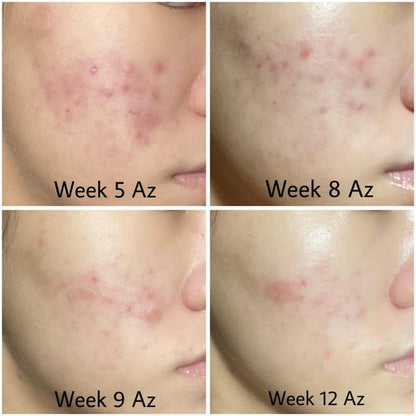 Celimax The Vita-A Retinal Shot Tightening Booster